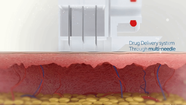 韓星秘密武器—水光針全攻略_悠美診所 水光注射全攻略_悠美診所