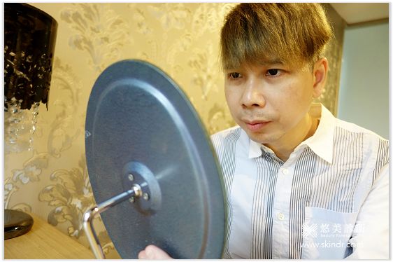 外開眼袋 割雙眼皮 悠美診所