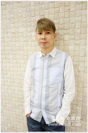 外開眼袋 割雙眼皮 悠美診所