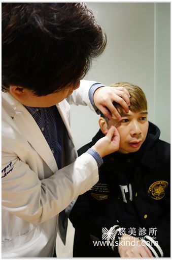 外開眼袋 割雙眼皮 悠美診所