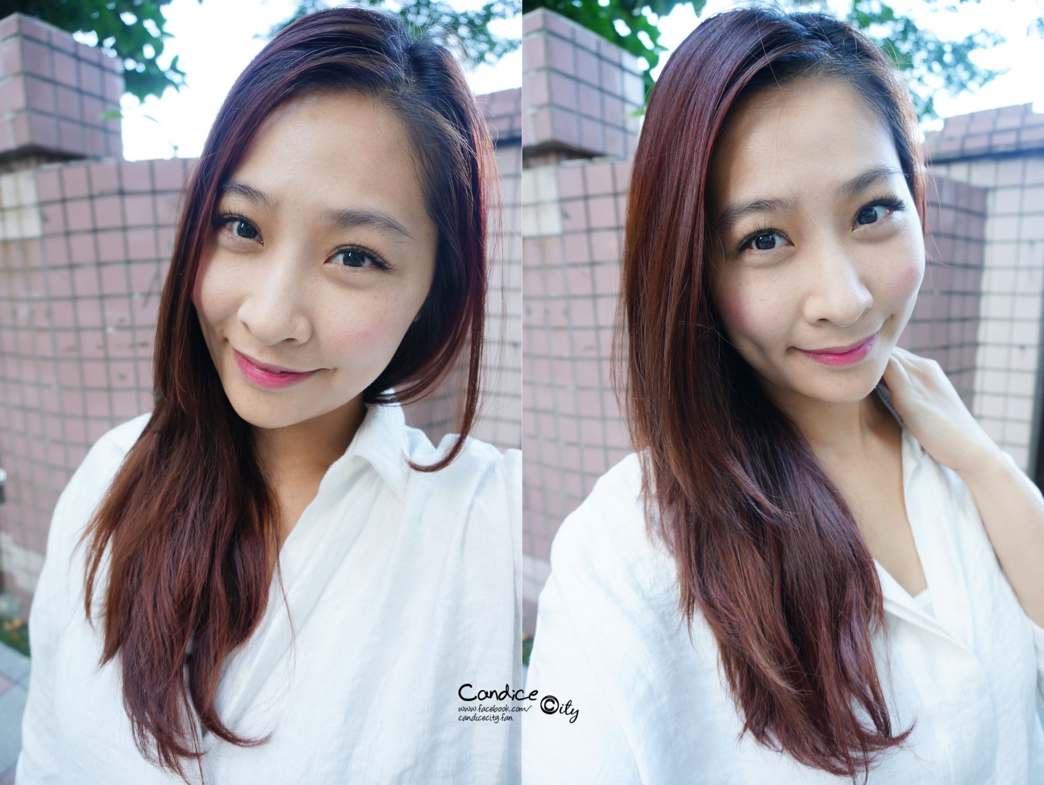 肉毒小臉 晶亮瓷下巴 悠美診所