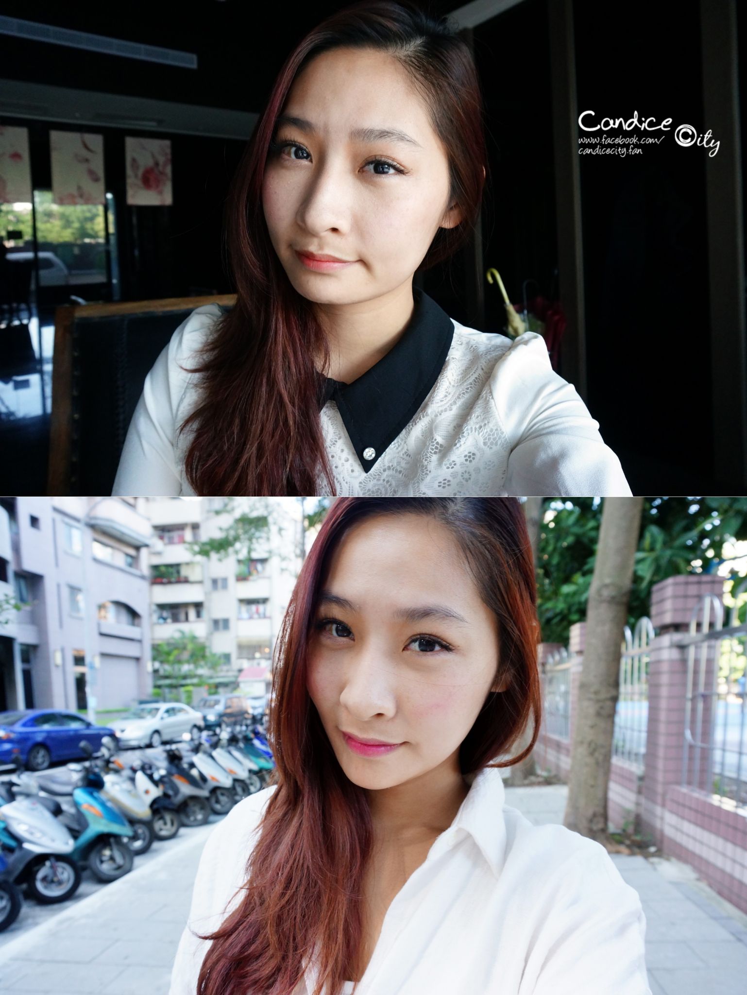 肉毒小臉 晶亮瓷下巴 悠美診所