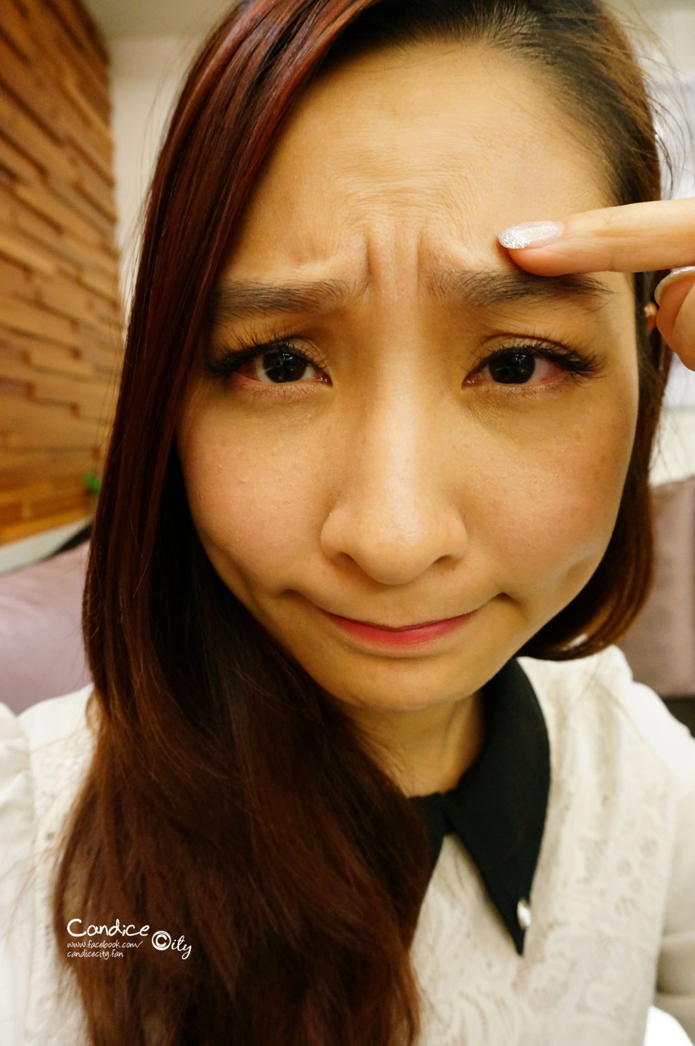 肉毒小臉 晶亮瓷下巴 悠美診所