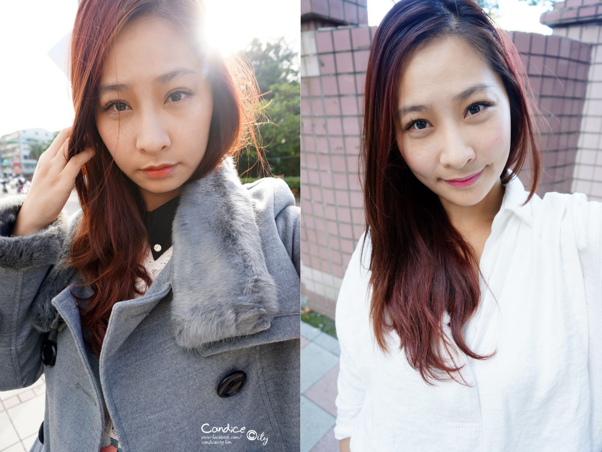 肉毒小臉 晶亮瓷下巴 悠美診所