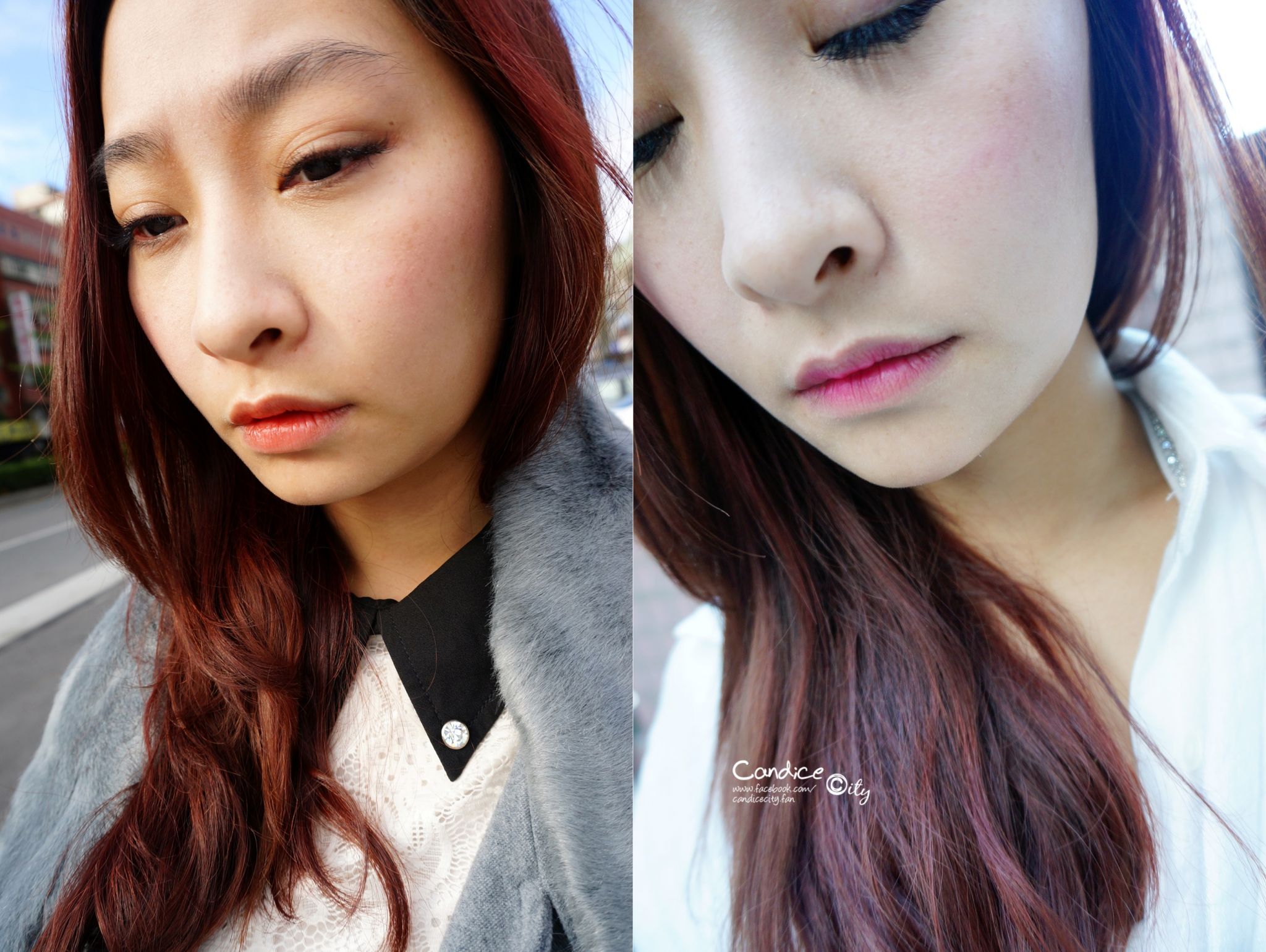 肉毒小臉 晶亮瓷下巴 悠美診所