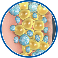 酷塑冷凍減脂治療原理：療程後，身體會自然代謝結晶化脂肪細胞。
