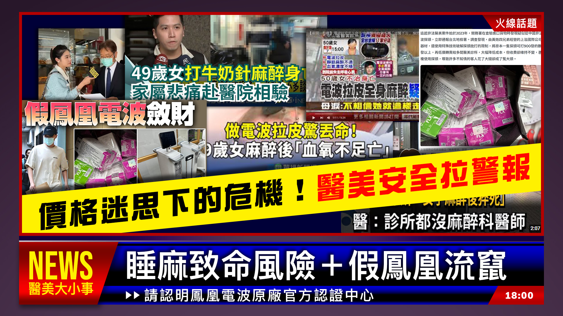 鳳凰電波麻醉安全