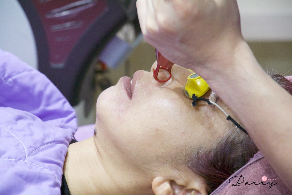皮秒雷射 紅寶石雷射 悠美診所