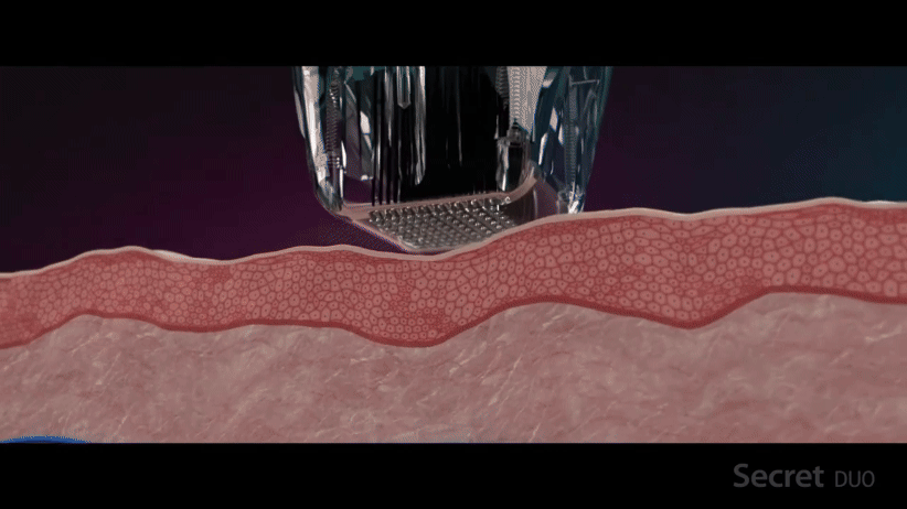 ILOODA電波除皺_悠美診所 ILOODA電波除皺_悠美診所