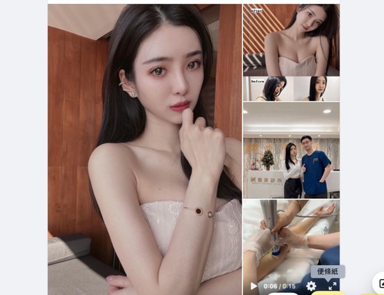 倍克脂Belkyra+Zwave體雕-悠美診所